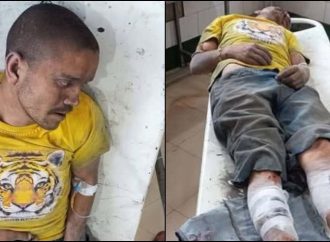 उत्तराखंड: यूट्यूबर बिरजू मयाल पर लोहे की रॉड से हमला, अज्ञात बदमाशों के खिलाफ मुकदमा